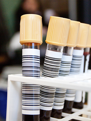 collected blood vials
